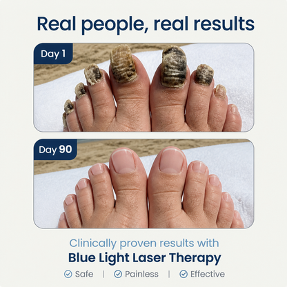 MycroLux - Toe Fungus Remover