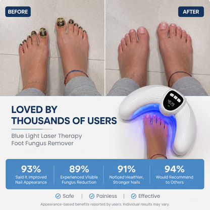 MycroLux - Toe Fungus Remover